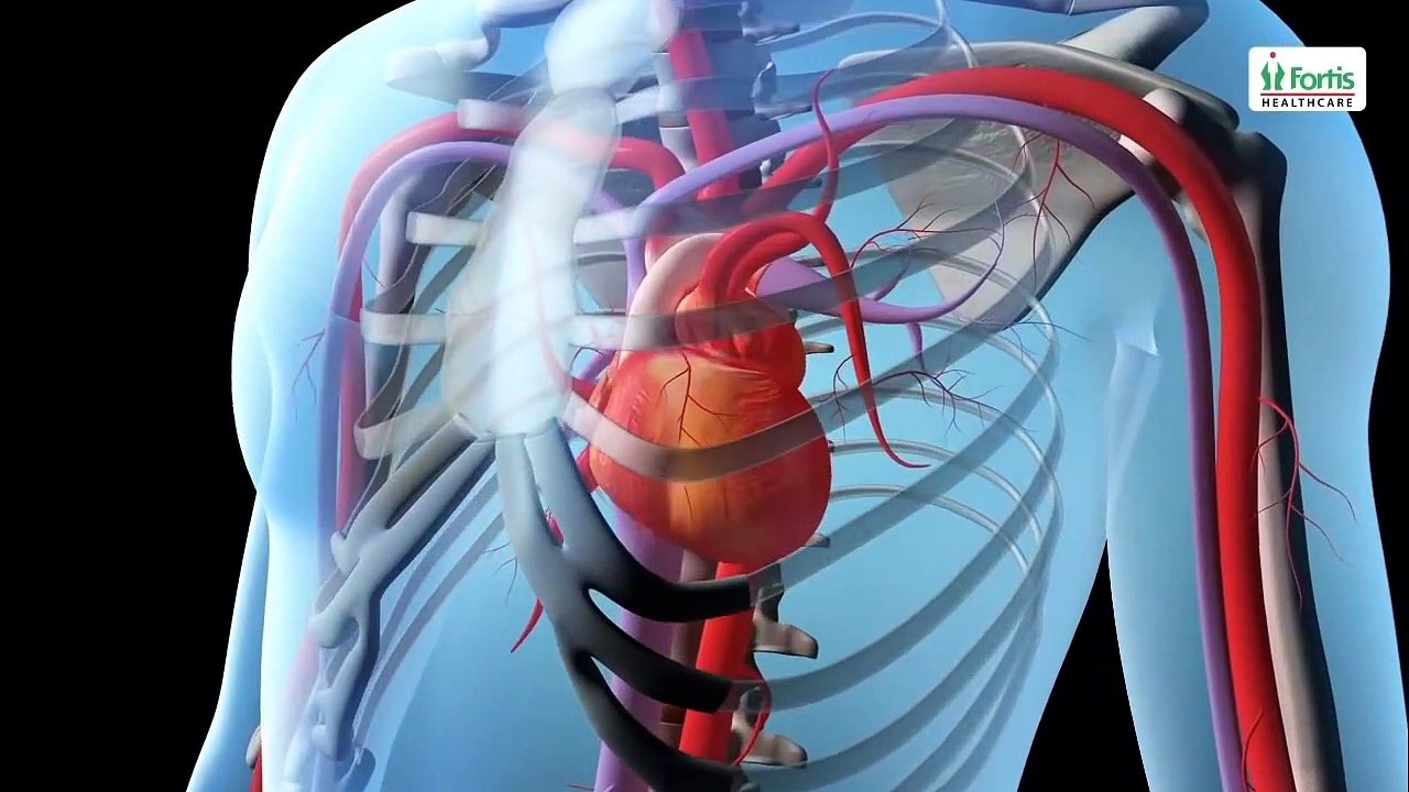 Angioplasty Procedure Animation Video. - video Dailymotion