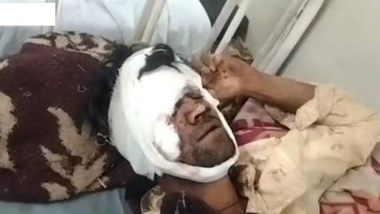 गुना: ससुराल से लौट रहे युवक को वाहन ने मारी टक्कर, हालत गंभीर