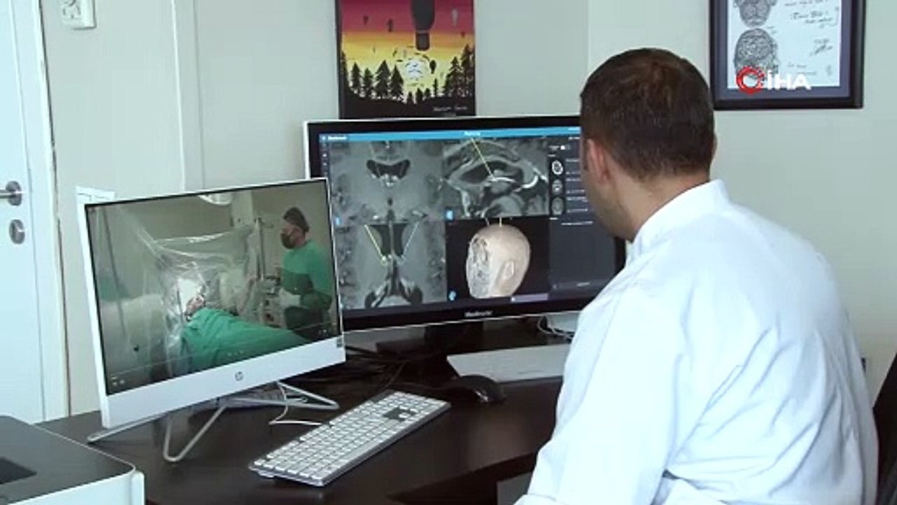 Epilepsi hastası şifayı Türkiye’de beyin pili ameliyatında buldu