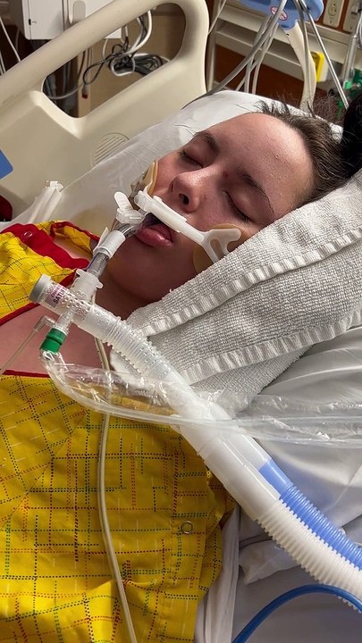 Woman Uses Sign Language to Communicate While in Medically Induced Coma
