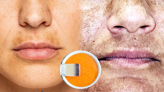 गर्मी में फेस पर क्या न लगाएं | Garmi Mein Face Par Kya Nahi Lagaein |Summer Skincare Tips |Boldsky