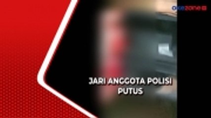 Terkena Sabetan Sajam Warga, Anggota Polisi di Labuan Bajo Kehilangan Dua Jarinya