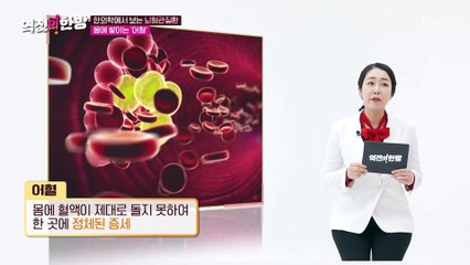 중년 남성보다 여성에게 발생 빈도가 더 높은 뇌졸중 TV CHOSUN 230317 방송