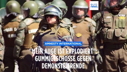 "Mein Auge ist explodiert" - Weltweit immer mehr Gummigeschosse gegen Protestierende