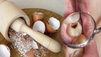 दांत सड़ने लगे तो क्या करें | Daant Sadne Lage To Kya Kare | Boldsky