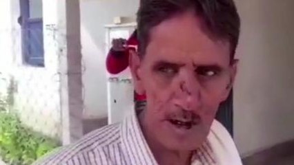 बड़वारा: कलयुगी पुत्र ने की पिता के साथ मारपीट, जानिए क्या है पूरा मामला