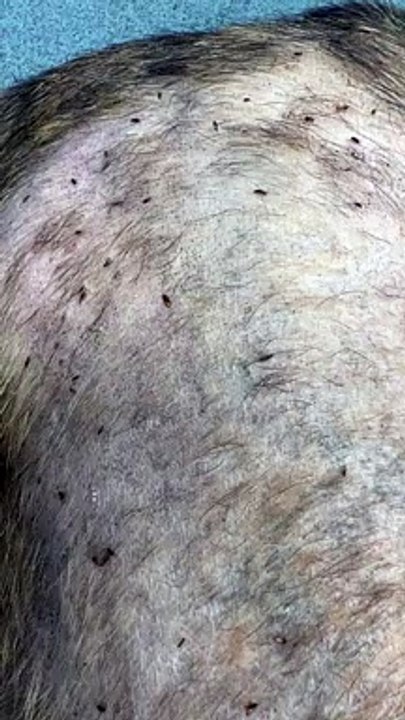 Newcastle dog with flea infestation