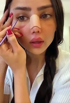 مروج الرحيلي نفسيتها تعبانه من بعد أجراء عملية تجميل انفها