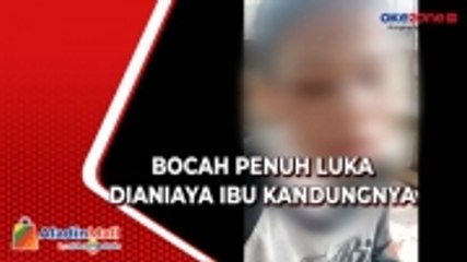 Bocah Linglung dan Penuh Luka Ditemukan di Pinggir Rel Kawasan Dewi Sartika Depok