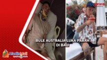 Viral! Warga Australia Mengaku Dianiaya di Bali, Polisi Tegaskan Bule Alami Kecelakaan Akibat Mabuk