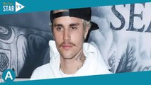 Justin Bieber atteint de paralysie faciale : le chanteur montre l'évolution de son état de santé en