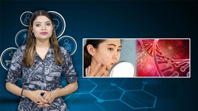 Hormonal Acne क्या होते है , हार्मोनल एक्ने कैसे पहचाने | Hormonal Acne Symptoms | Boldsky