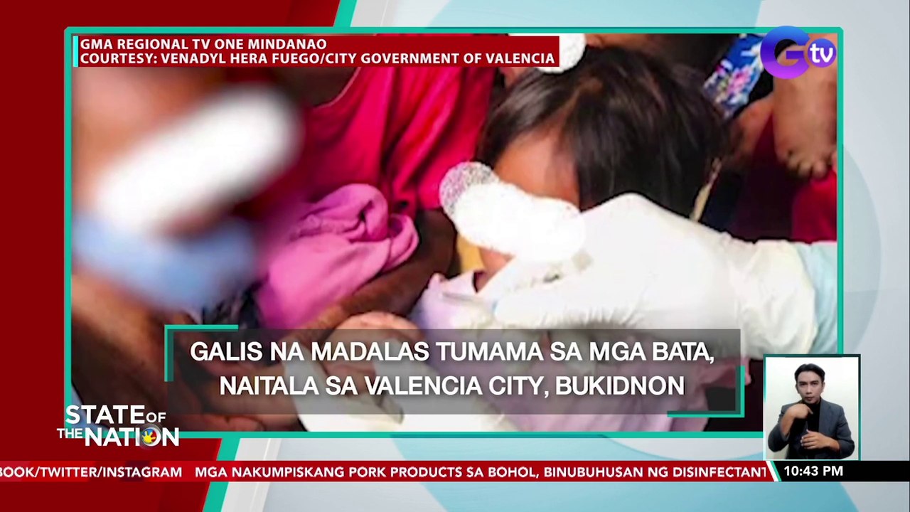 Galis na madalas tumama sa mga bata, naitala sa Valencia City, Bukidnon | SONA