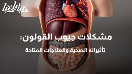 مشكلات جيوب القولون والنظام الغذائي الصحيح