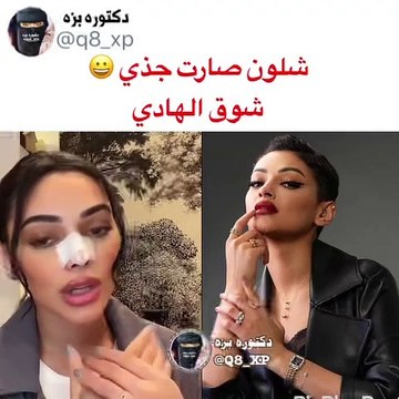شوق الهادي تكشف تفاصيل عملية التجميل التي خضعت لها في أول ظهور
