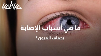 ما هي أسباب الإصابة بجفاف العيون؟
