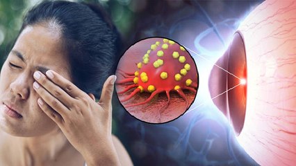 आंख में चिपचिपापन Conjunctivitis Symptoms, आँखों में खुजली और जलन भी शामिल | Boldsky