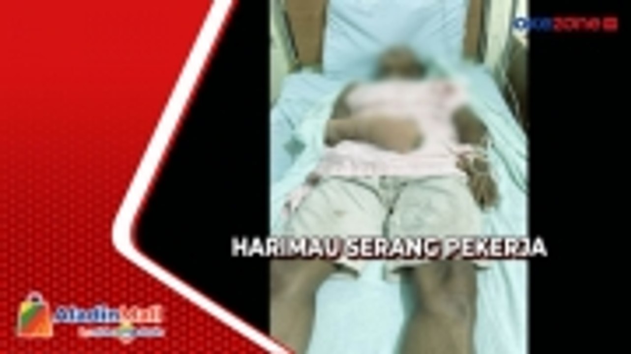 Ngeri, Pekerja di Riau Kritis setelah Diserang Harimau