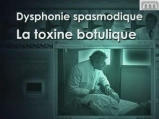 Dysphonie spasmodique, la toxine botulique