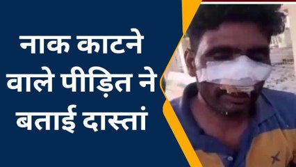 नागौर : तालिबानी तरीके से काटी गई युवक की नाक, पीड़ित आया मीडिया के सामने बताई दस्ता
