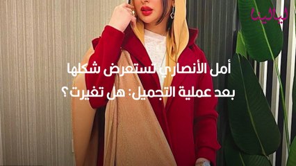 أمل الأنصاري تستعرض شكلها بعد عملية التجميل