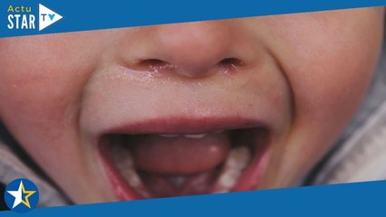 Accident de Pierre Palmade : le petit garçon gravement blessé contraint de retourner à l'hôpital