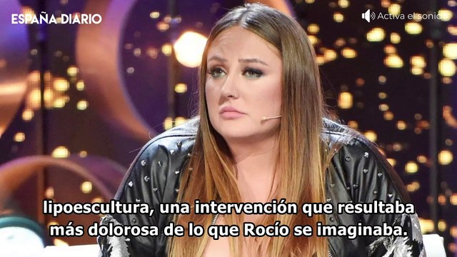 Rocío Flores, antes y después: sus operaciones y las fotos que lo confirman