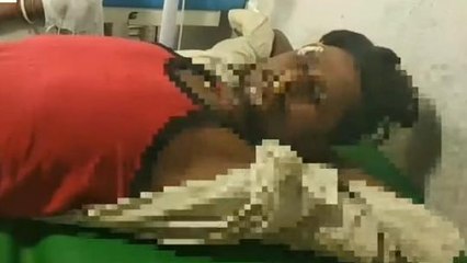 नालंदा: मां की मौत की खबर सुन देखने जा रहे बेटे का हुआ एक्सीडेंट, अस्पताल में कराया गाय भर्ती