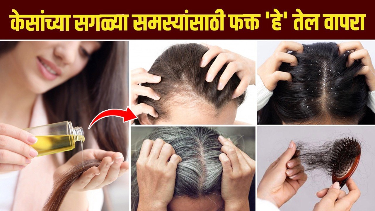 केसांच्या सर्व समस्यांसाठी करा हा उपाय | How to Get Rid of Hair Problems | Hair Oil Homemade | MA 2