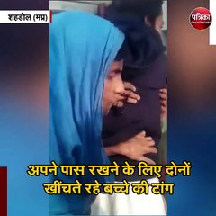 पति-पत्नी की लड़ाई में बच्चे का हुआ बुरा हाल