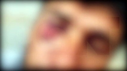 Homem é agredido durante abordagem da GM no Riviera