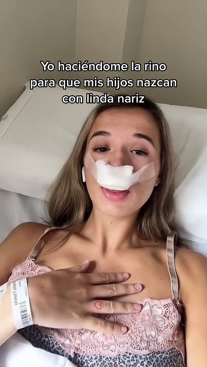 Mujer se hace rinoplastia