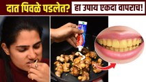 How to Clean Teeth with Ginger and Colgate | पिवळे दात चमकवा फक्त 2 मिनिटांत | Teeth Whitening | RI2