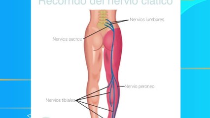 bd-como-ayuda-el-laser-a-mejorar-molestias-por-ciatica-230323