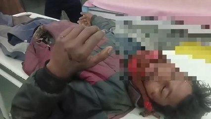 बैतूल: युवक को शराब पीकर गाड़ी चलाना पड़ा भारी, अनियंत्रित होकर ट्रक में जा घुसा