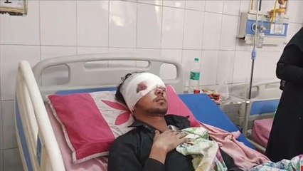 मुरादाबाद:दो बाइकों की भिड़ंत में दोनों बाइक सवार युवक हुए गंभीर रूप से घायल