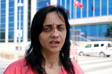 TANIMADIĞI GAMZE'Yİ YUMRUKLAYAN SALDIRGAN İÇİN 6 YILA KADAR HAPİS İSTEMİ