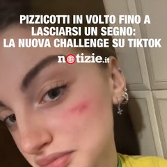 Cicatrice francese: la pericolosa nuova challenge di TikTok che preoccupa le scuole