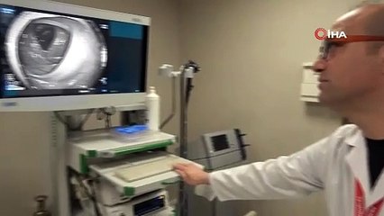 Kolonoskopi yöntemi ile 20 dakikalık işlem sonrası tedavi olanlar, 5 dakika sonra taburcu oluyor