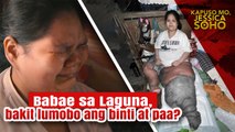 Babae sa Laguna, lumobo ang kaliwang binti at paa | Kapuso Mo, Jessica Soho