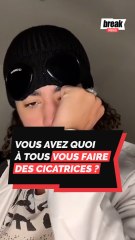 Vous avez quoi à tous vous faire des cicatrices ?