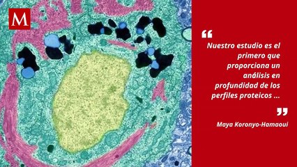Alzheimer podría ser detectado por daños en la retina, según estudio