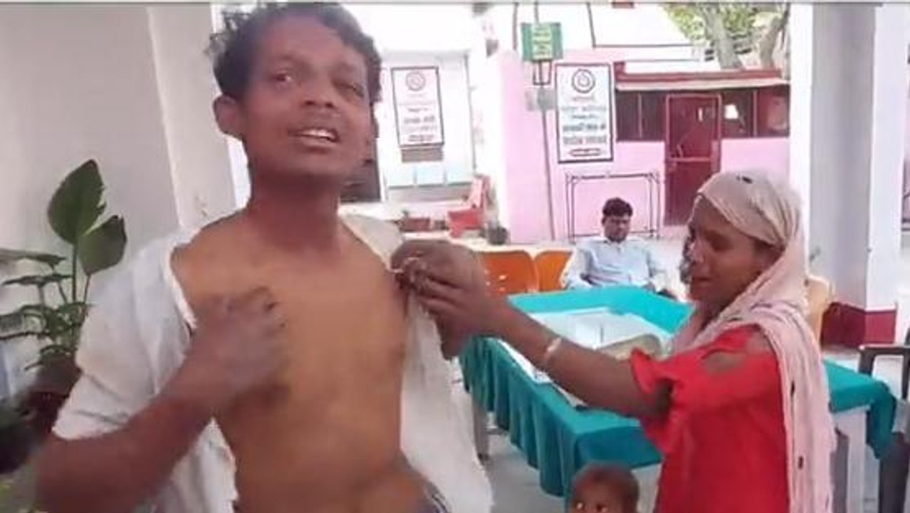 गौतमबुद्ध नगर: मजदूरी मांगने पर ठेकेदार ने पति-पत्नी को लाठी-डंडे से पीट-पीटकर किया घायल