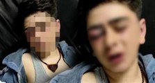 14 yaşındaki çocuğa darp iddiasında iki polis hakkında daha tutuklama kararı
