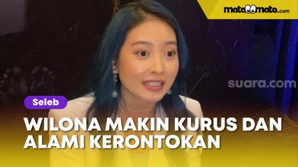 Banyak Pikiran, Natasha Wilona Makin Kurus dan Alami Kerontokan Rambut
