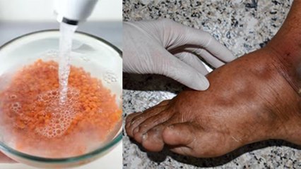 दाल पकाने से पहले पानी में भिगोना जरुरी क्यों ? । Dal Pakane Se Phele Pani Me Bhigona Jaruri Kyu