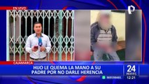 Cajamarca: hijo quema las extremidades a su padre por no dejarle herencia