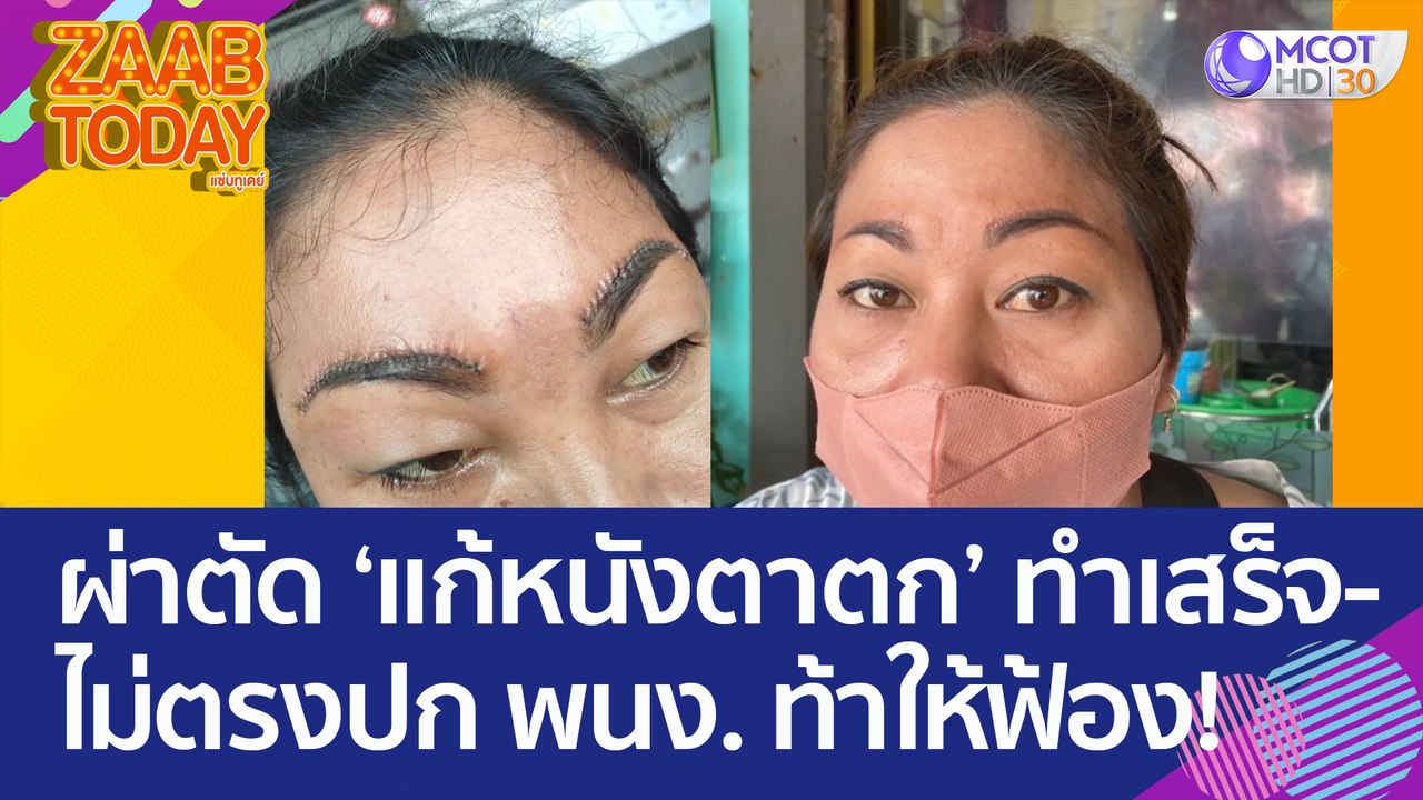 ช้ำใจ! สาวผ่าตัดแก้หนังตาตก ทำเสร็จไม่ตรงปก เจอ...