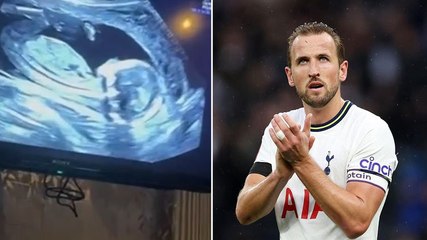 Harry Kane shares ultrasound to announce wife is expecting their fourth child