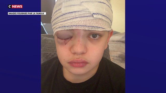 Harcèlement scolaire : Farès, 12 ans, handicapé, victime de violences à répétition